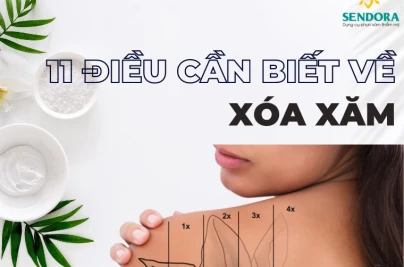 Những Điều Cần Biết Khi Xóa Hình Xăm: Hướng Dẫn An Toàn & Hiệu Quả 11 dieu can biet ve xoa hinh xam de tranh ruoc hoa vao than.jpg