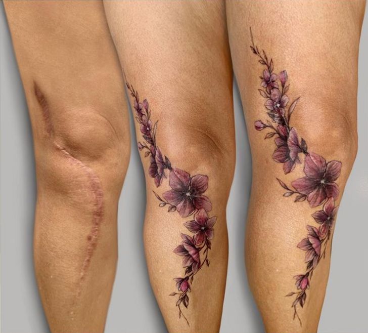 Scar Cover Up Tattoo Vietnam: Expert Guide, Costs & Results 6 Creative scar cover up tattoo design demonstrating artistic camouflage techniques