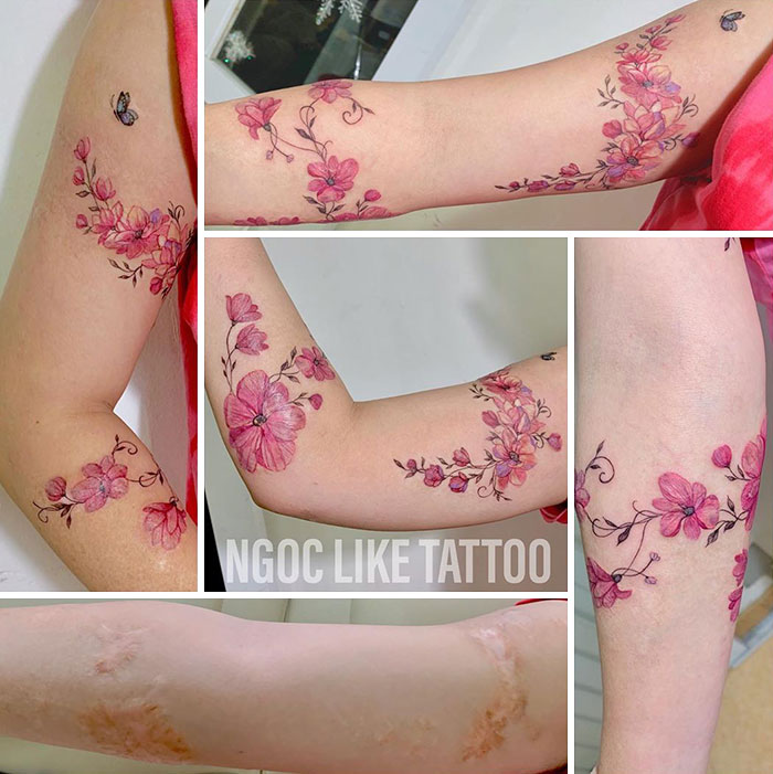 Scar Cover Up Tattoo Vietnam: Expert Guide, Costs & Results 5 Scar cover up tattoo transforming visible scar tissue into artistic design