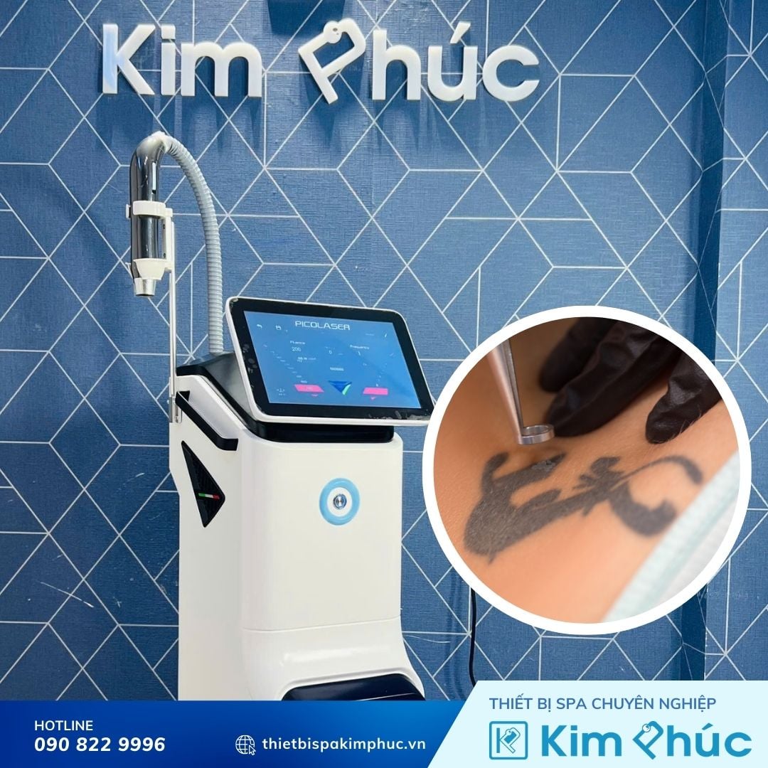 So sánh máy xóa xăm Pico và Q-Switch