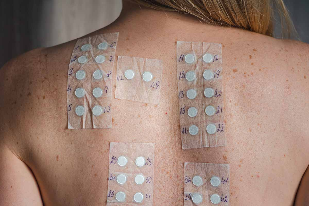 Tattoo Skin Patch Test: Do You Need One Before a Tattoo? 7 Dermatologist evaluating tattoo skin patch test results before tattoo procedure